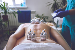 cupping therapy wayne nj